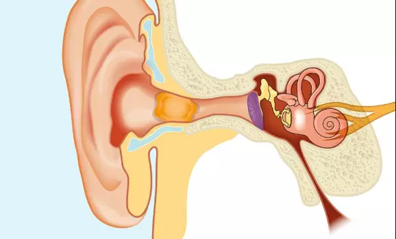 Ráy tai tích tụ quá nhiều làm tắc nghẽn ống tai và gây điếc dẫn truyền
