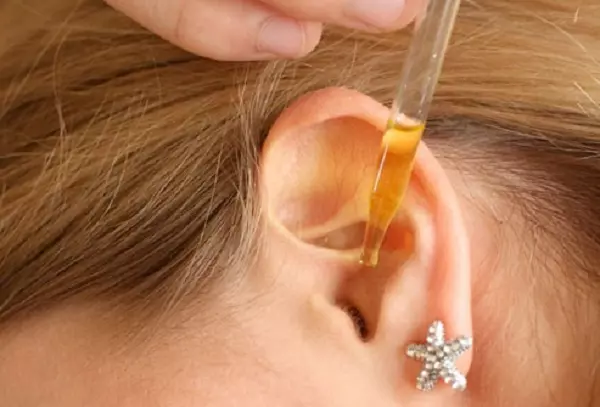 Thuốc nhỏ tai chứa hydrogen peroxide giúp cải thiện ù tai do ráy tai