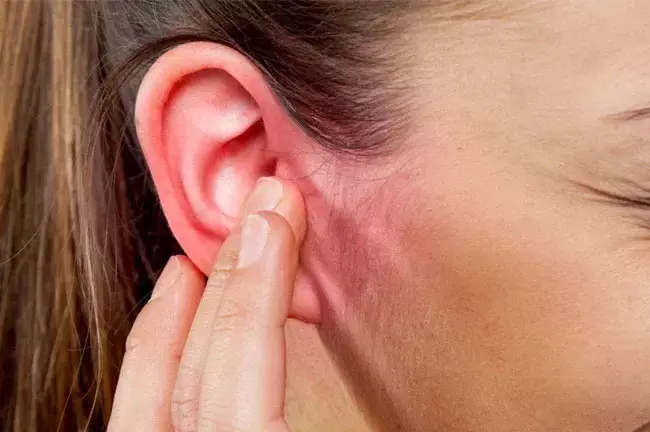 Viêm tai ngoài có thể do nhiều nguyên nhân khác nhau gây ra
