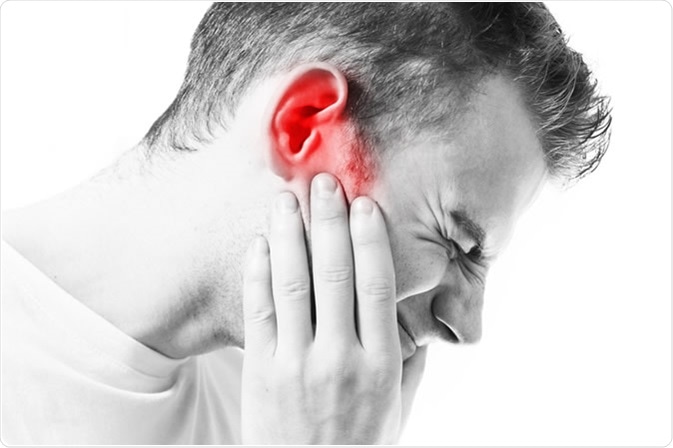 Tổn thương ở tai trong có thể gây ù tai