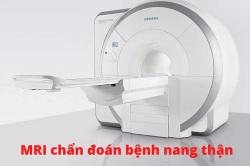 Chup-cong-huong-tu-MRI-giup-chan-doan-phan-biet-nang-than