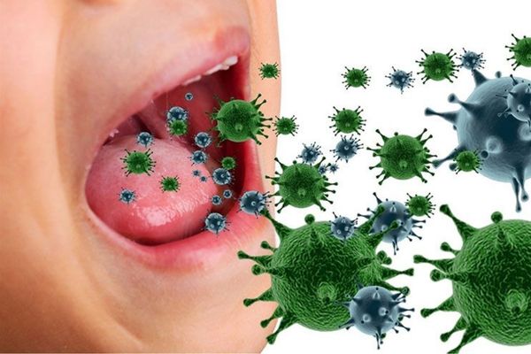 Virus là nguyên nhân gây viêm họng chủ yếu