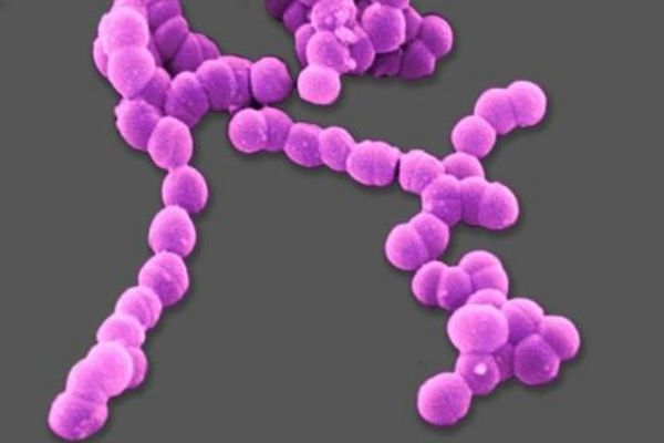 Streptococcus pseudo pneumoniae là một trong những chủng gây tổn thương dây thanh
