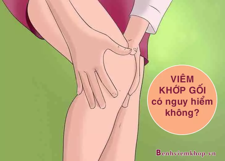 Bệnh viêm khớp gối có nguy hiểm không? Câu trả lời ở đây!