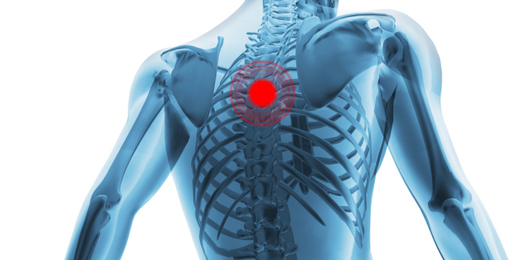 Đau cột sống lưng trên thường xuất hiện các cơn đau nhức ở vị trí lưng từ T1 - T12