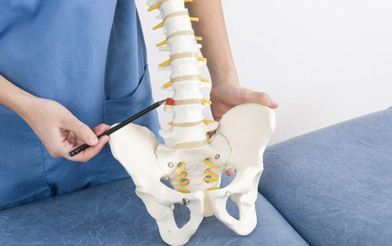 Thoát vị đĩa đệm có thể dẫn đến đau 2 bên thắt lưng