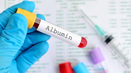 Xét nghiệm albumin giúp chẩn đoán suy thận