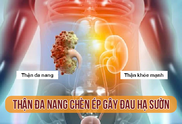 Than-da-nang-chen-ep-gay-dau-ha-suon.webp