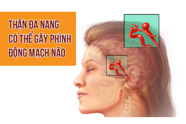 Than-da-nang-co-the-gay-phinh-dong-mach-nao.webp