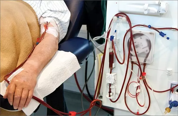 Khi chức năng thận không còn hoạt động như bình thường, người bệnh được chỉ định lọc máu nhân tạo