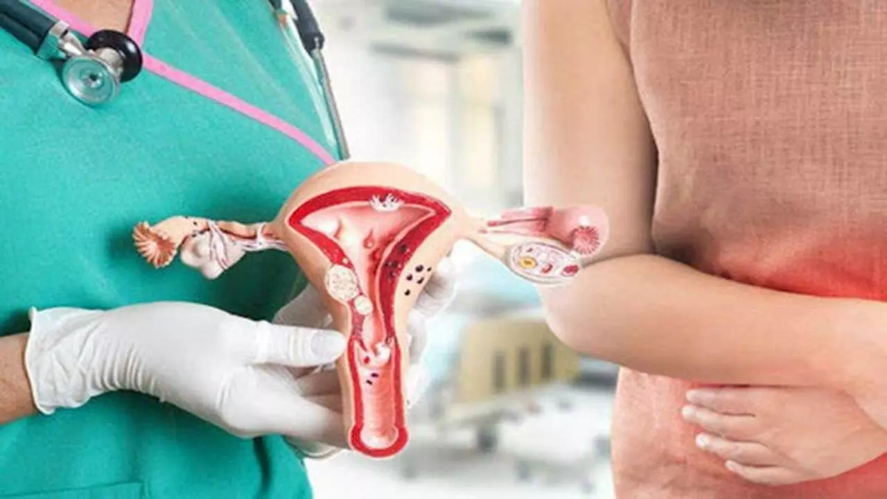 U xơ tử cung là một trong những nguyên nhân ảnh hưởng đến việc mang thai