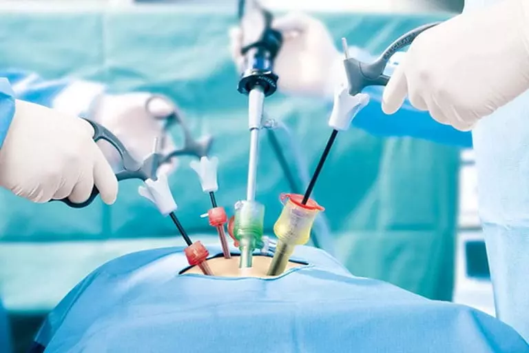 Cận cảnh u xơ tử cung trong một ca phẫu thuật mổ hở