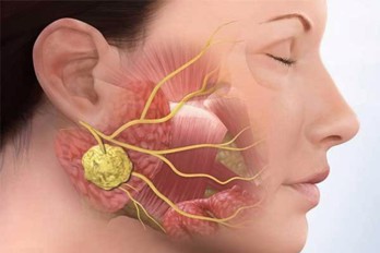 Chứng đau tai khi nhai và 9 bệnh lý không thể xem thường