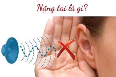 Nặng tai là gì? Nguyên nhân, triệu chứng và cách khắc phục