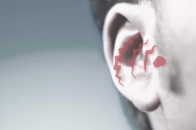 Vạch mặt 5 triệu chứng bệnh viêm tai giữa bạn không thể bỏ qua