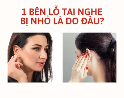 Nguyên nhân 1 bên lỗ tai nghe bị nhỏ và cách phòng tránh