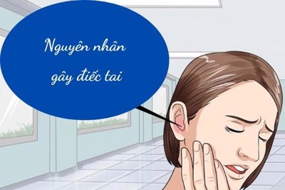 Nguyên nhân và cách điều trị điếc tai