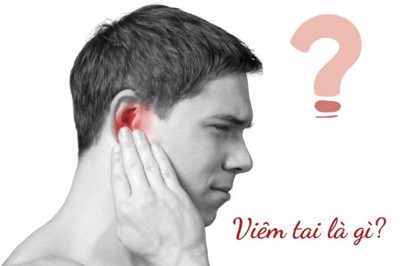 Viêm tai: Triệu chứng, nguyên nhân và cách điều trị hiệu quả