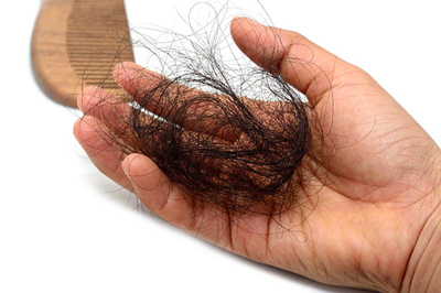 Phòng ngừa rụng tóc ở bệnh nhân mắc bệnh tuyến giáp như thế nào?