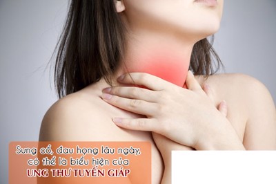 Đừng chủ quan với sưng cổ, đau họng lâu ngày, vì đó có thể là biểu hiện của UNG THƯ TUYẾN GIÁP