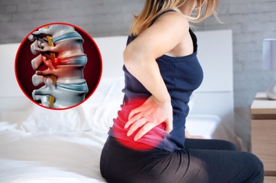 Hội chứng đau thắt lưng hông: Triệu chứng và cách điều trị
