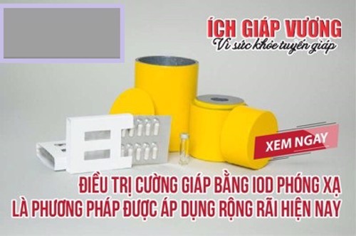 Điều trị cường giáp bằng iod phóng xạ có tốt không? Giải pháp thảo dược giúp cải thiện bệnh