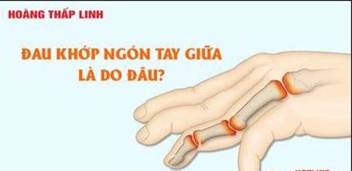 Mách bạn cách chữa đau khớp ngón tay giữa hiệu quả từ thảo dược. Click xem ngay!