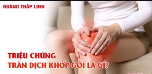 Triệu chứng tràn dịch khớp gối và cách điều trị hiệu quả từ thảo dược