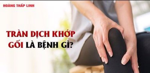 Note ngay 5 mẹo chữa tràn dịch khớp gối hiệu quả tại nhà! Click xem ngay!